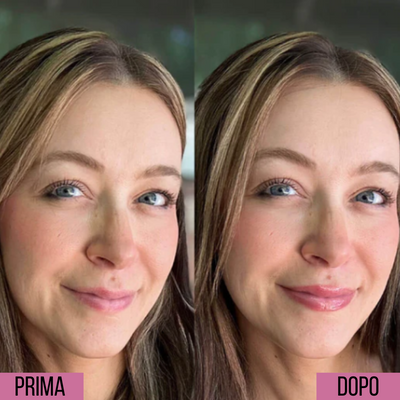 Lumion Rullo Rimpolpante
