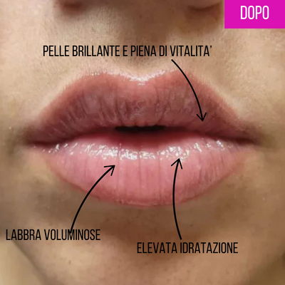 Lumion Rullo Rimpolpante