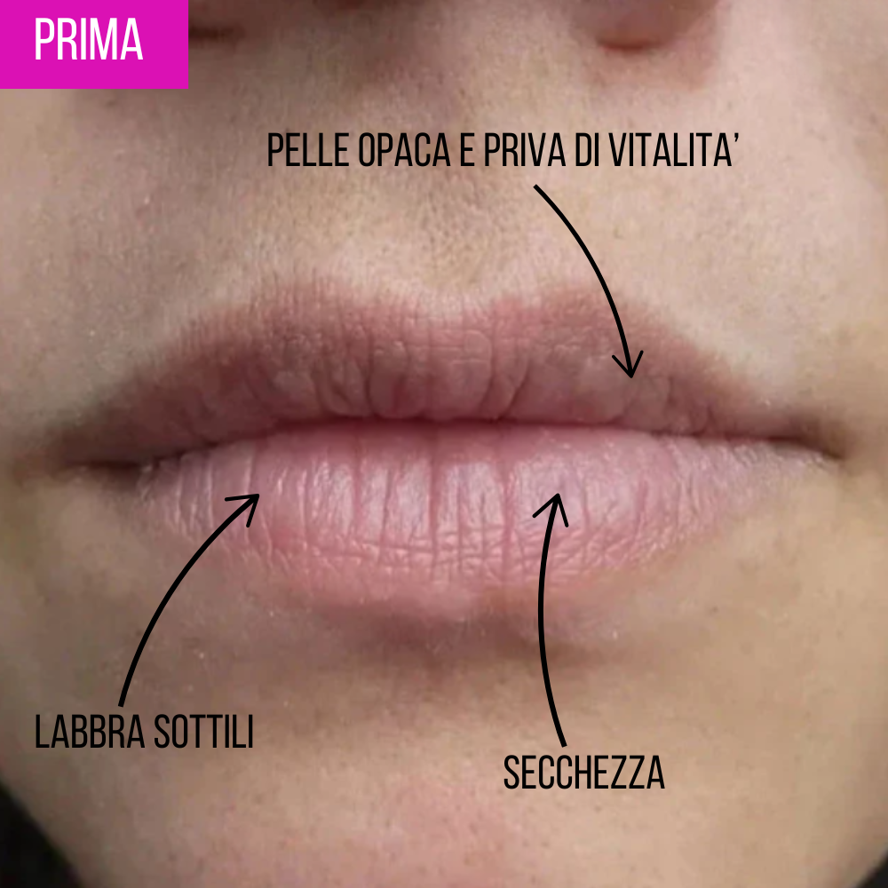 Lumion Rullo Rimpolpante