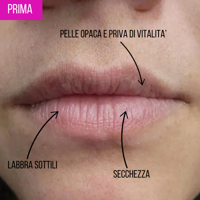 Lumion Rullo Rimpolpante